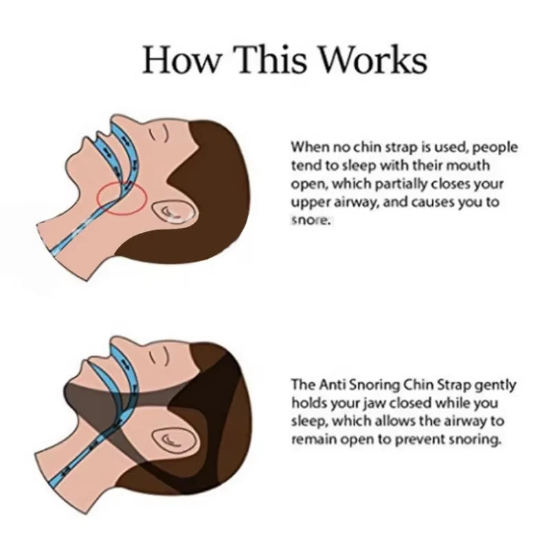 Adjustable anti Snoring Sleep Apnea Belt Triangular Headband Chin Jaw Support Strap Unisex Headband Neoprene Medical Health Care